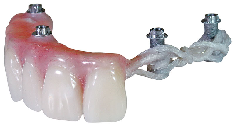 cst denture