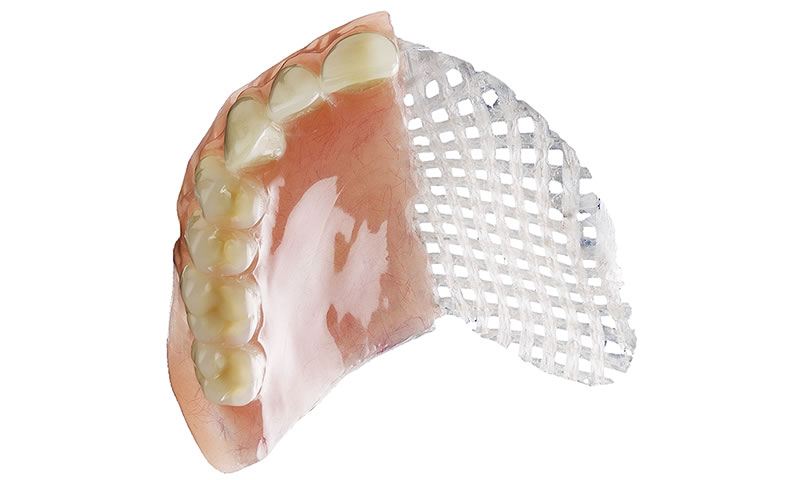 fiberforce denture